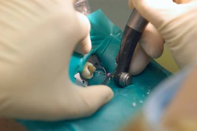 Los 8 mejores tratamientos de estética dental en Málaga 2026